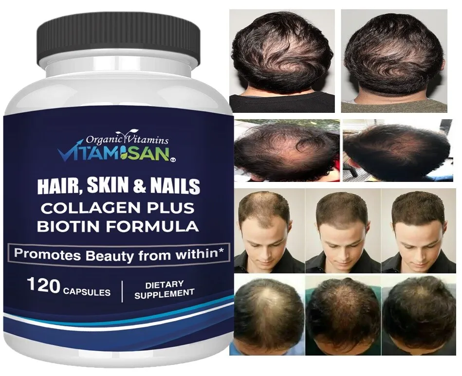 hair growth vitamins for men
